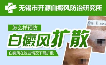 無錫白癲瘋醫院怎么治療介紹青少年白斑治療難度為什么較大