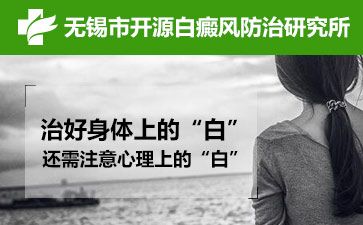 無錫開源白斑醫院怎么樣講解早期小兒白斑的癥狀表現有什么